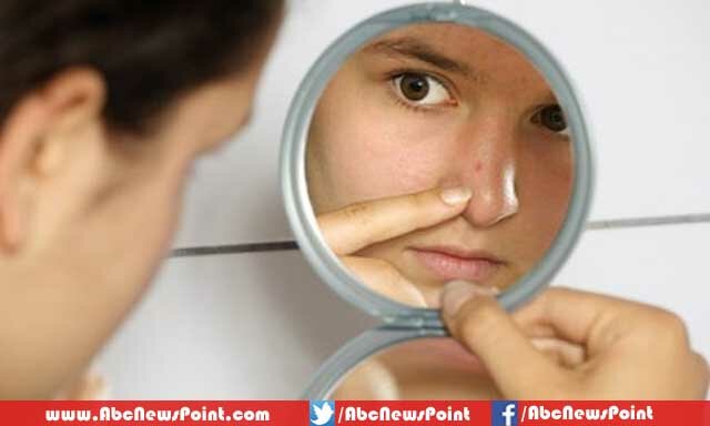 Top-10-Simple-Ways-To-Beautify-Your-Face-Treat-the-Pimples-and-Wrinkles